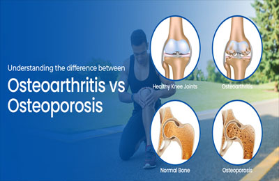 Geriatric Conditions